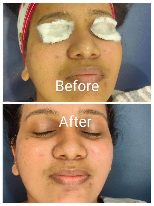 Setu-Best Cosmetology,Sexology Clinic 08042781361 gallery