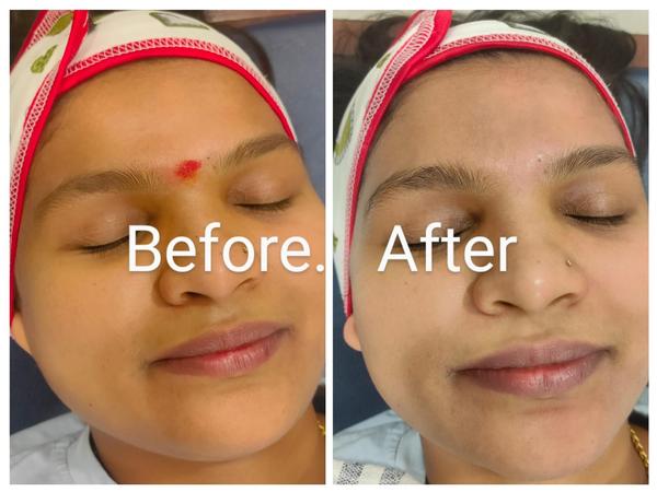 Setu-Best Cosmetology,Sexology Clinic 08042781361 gallery