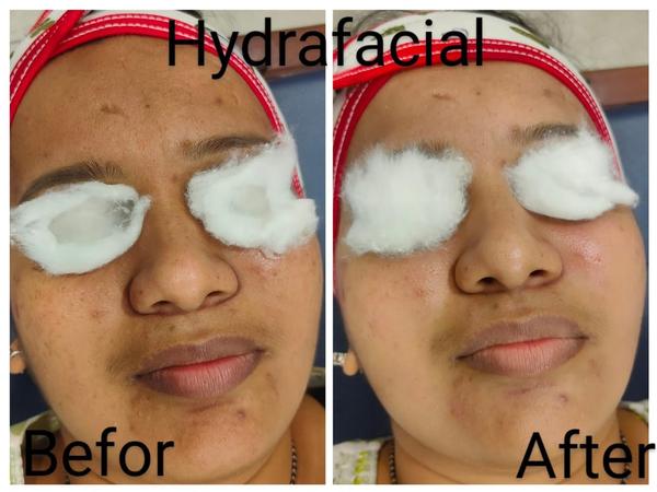 Setu-Best Cosmetology,Sexology Clinic 08042781361 gallery