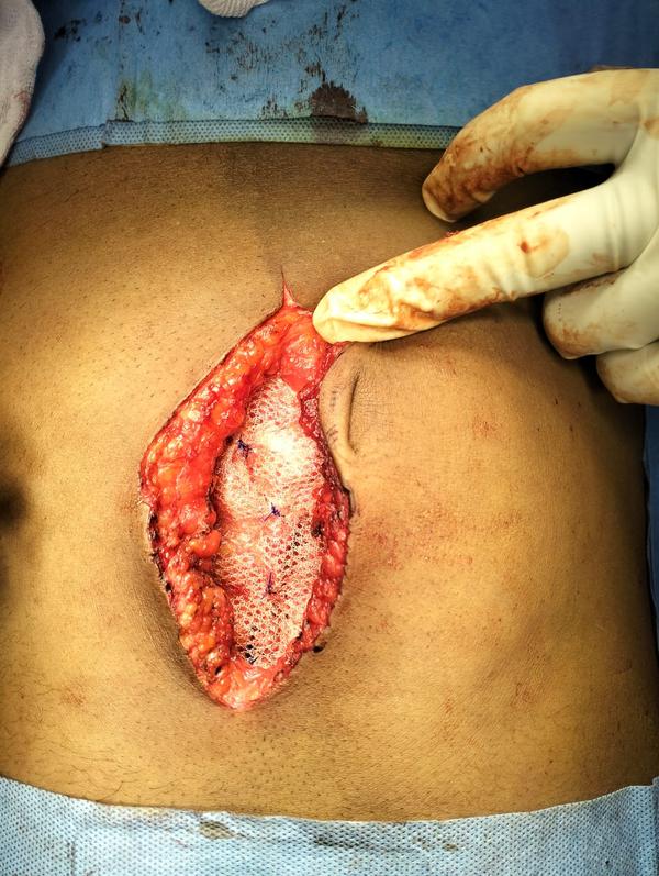 S A Hospital gallery