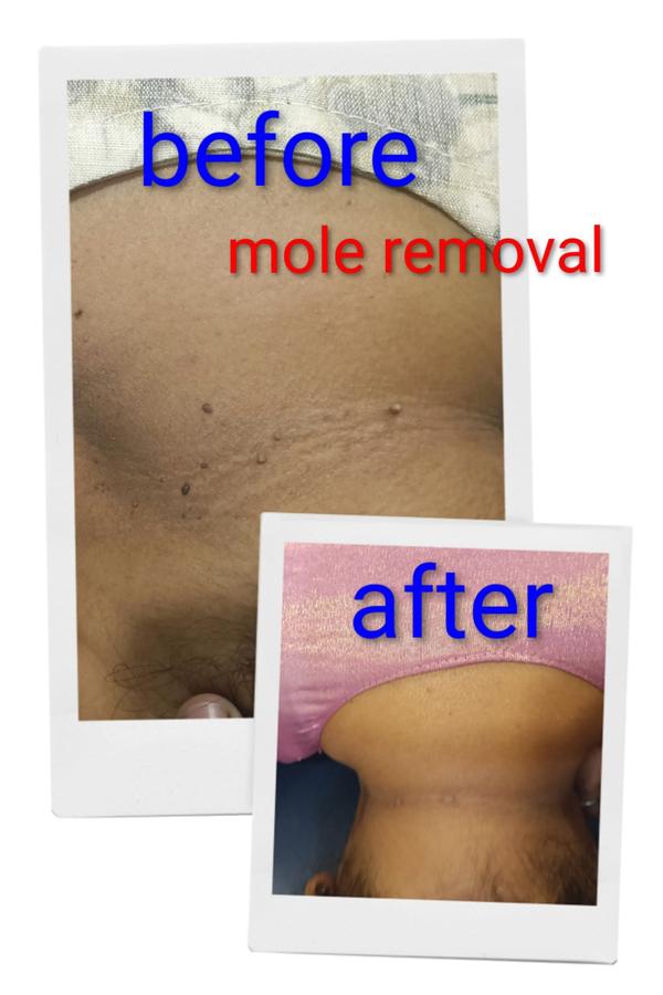 Setu-Best Cosmetology,Sexology Clinic 08042781361 gallery