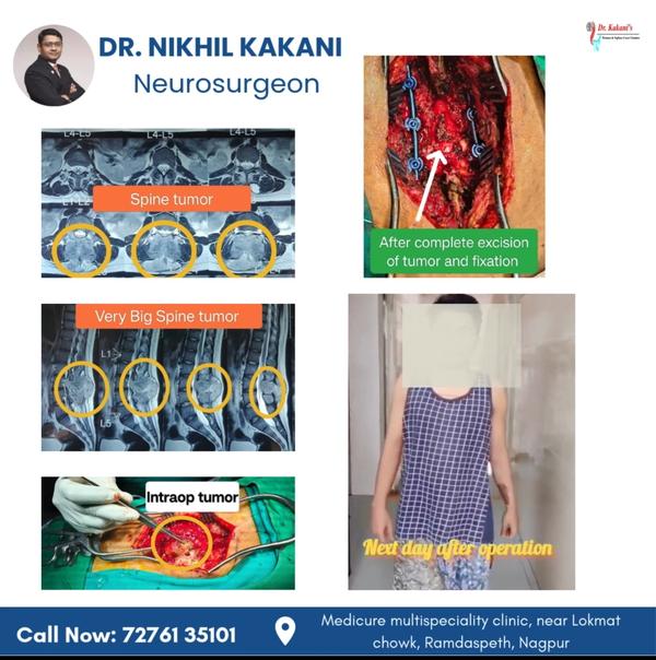 Dr Kakani Neuro and Spine Care Centre gallery