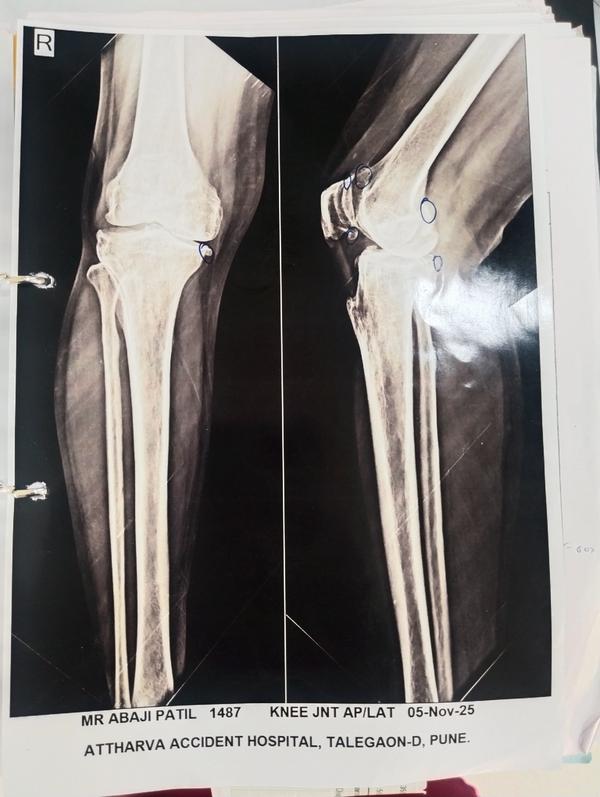 ATTHARVA HOSPITAL gallery