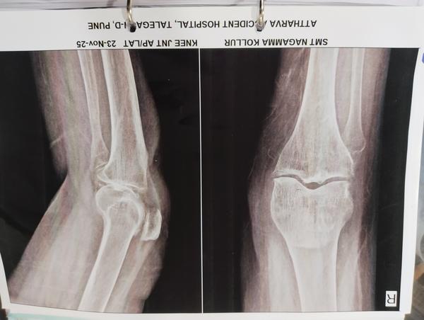 ATTHARVA HOSPITAL gallery