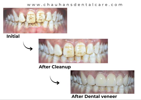 Chauhan's Dental Care gallery
