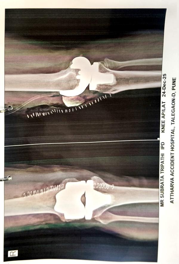 ATTHARVA HOSPITAL gallery