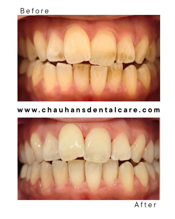 Chauhan's Dental Care gallery