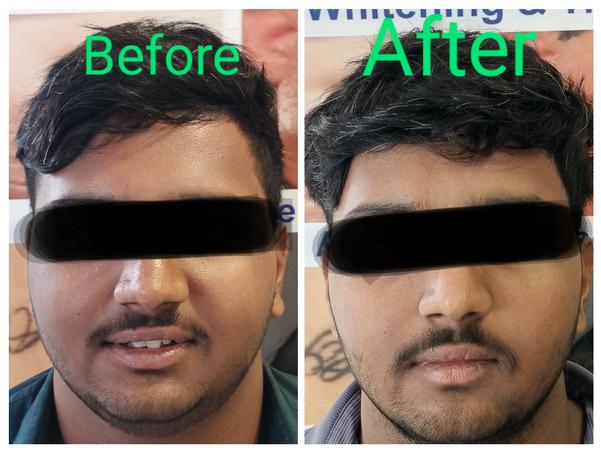 Setu-Best Cosmetology,Sexology Clinic 08042781361 gallery