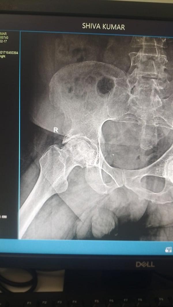 SUNSHINE SUPER SPECIALITY PHYSIOTHERAPY CLINIC gallery