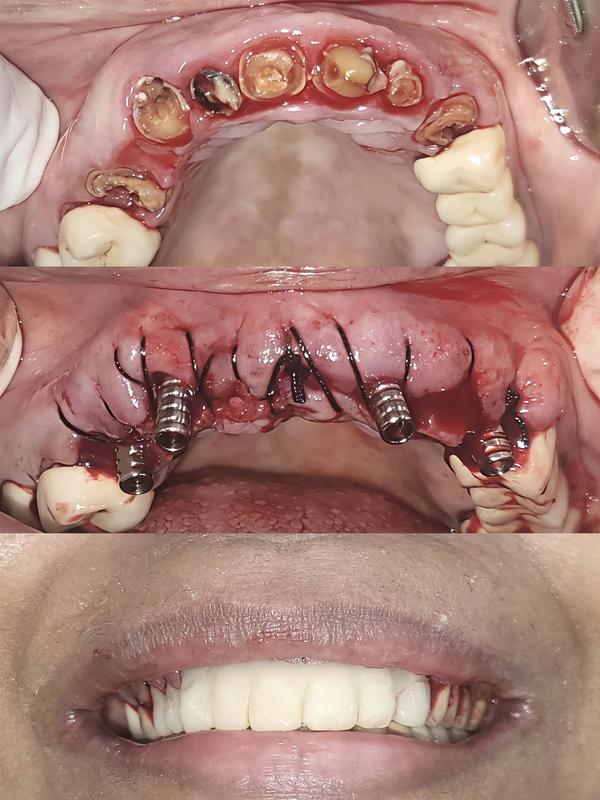 Om Dental and Implant Centre gallery