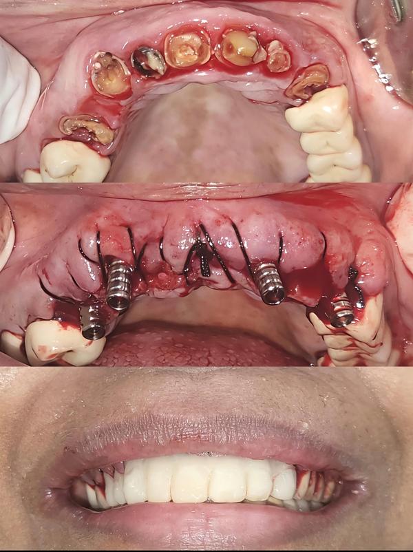 Om Dental and Implant Centre gallery