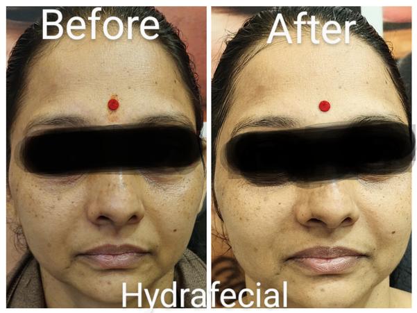 Setu-Best Cosmetology,Sexology Clinic 08042781361 gallery