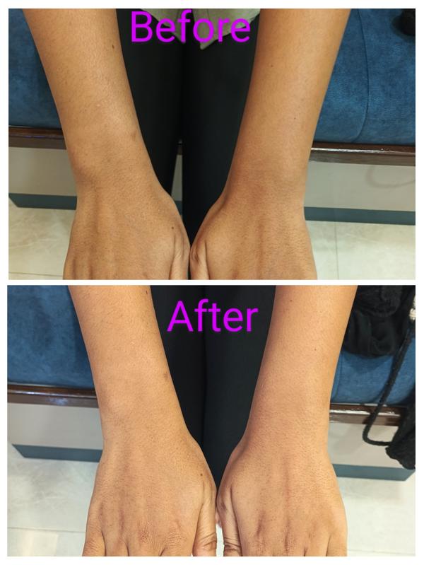 Setu-Best Cosmetology,Sexology Clinic 08042781361 gallery