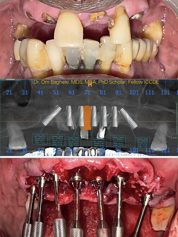 Om Dental and Implant Centre gallery