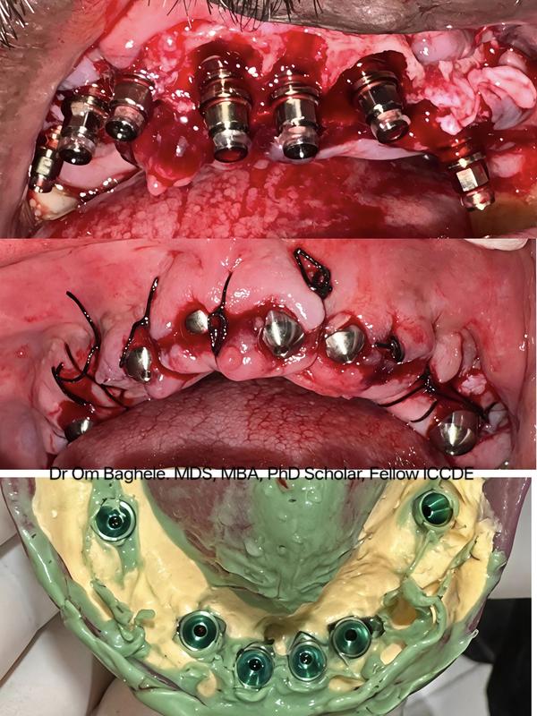 Om Dental and Implant Centre gallery