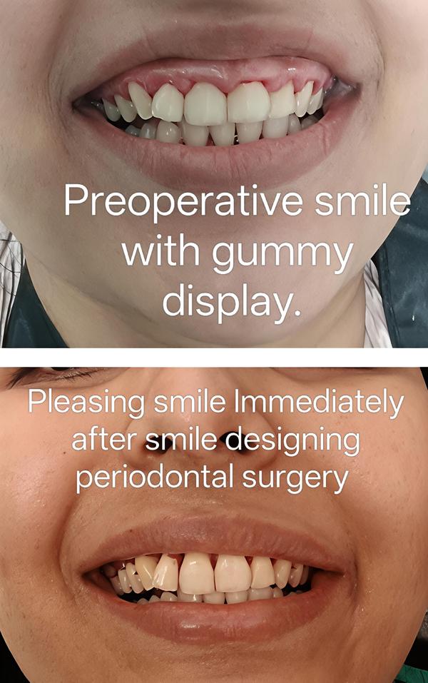 Om Dental and Implant Centre gallery